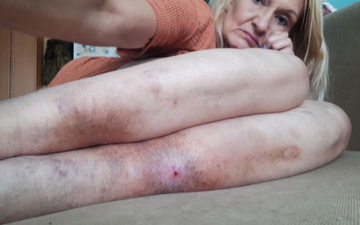 Zbiórka Wynejem mieszkania dla mamy - zdjęcie główne