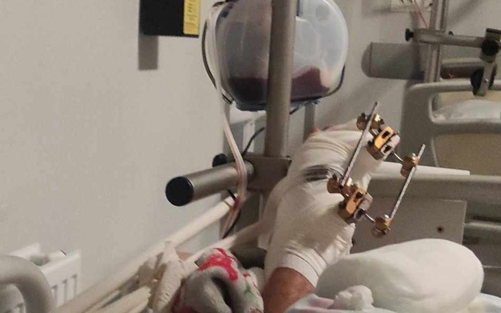 Zbiórka Zbieram na rehabilitację stopy - zdjęcie główne