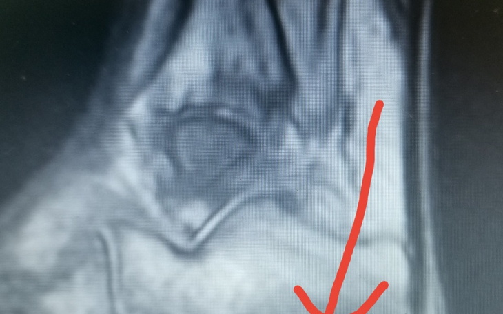 Zbiórka Na uratowanie firmy - zdjęcie główne