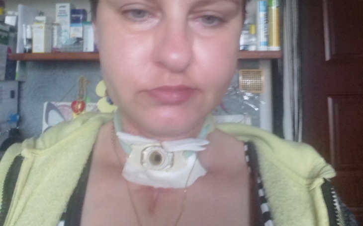 Kobieta z tracheostomią, wyrażająca swoje emocje w trudnej sytuacji.