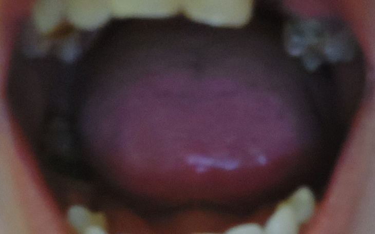 Zbiórka Na ratunek zębom i nowe okulary - zdjęcie główne