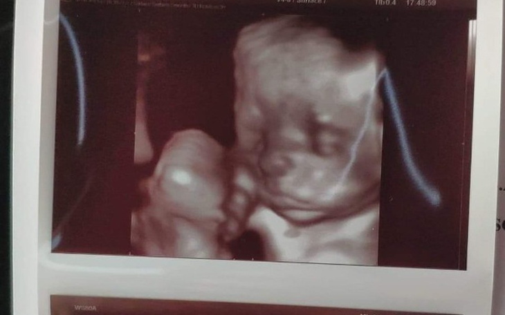 Zbiórka Pieniądze na nowego braciszka. - zdjęcie główne