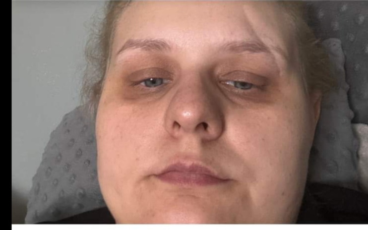 Zbiórka zbiórka ma leczenie - zdjęcie główne