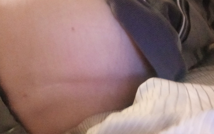 Zbiórka Zabiegi rehabilitacji kręgosłupa - zdjęcie główne