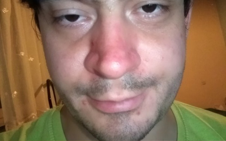 Zbiórka Leczenie porażenia mózgowego - zdjęcie główne