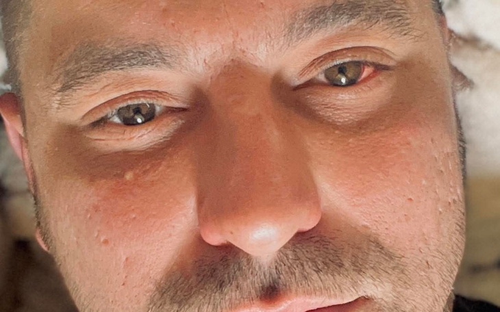 Portret mężczyzny z bliska, z wyraźnymi rysami twarzy.