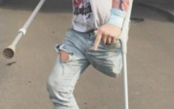 Zbiórka Proteza dla Mikiego - zdjęcie główne