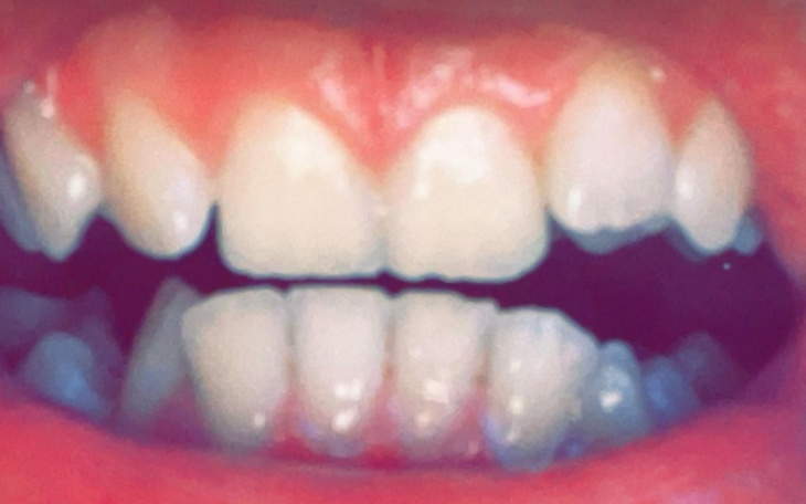 Zbiórka na zdrowe ząbki - zdjęcie główne