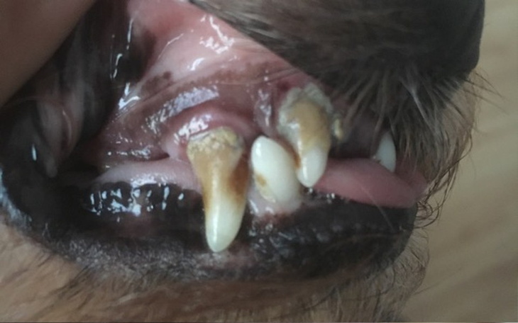 Zbiórka Na usunięcie kamienia na zębach - zdjęcie główne