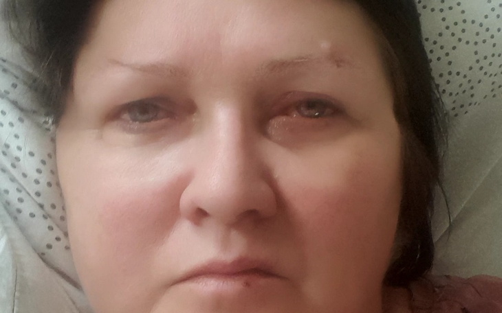 Zbiórka Chirurgia naczyniowa - zdjęcie główne