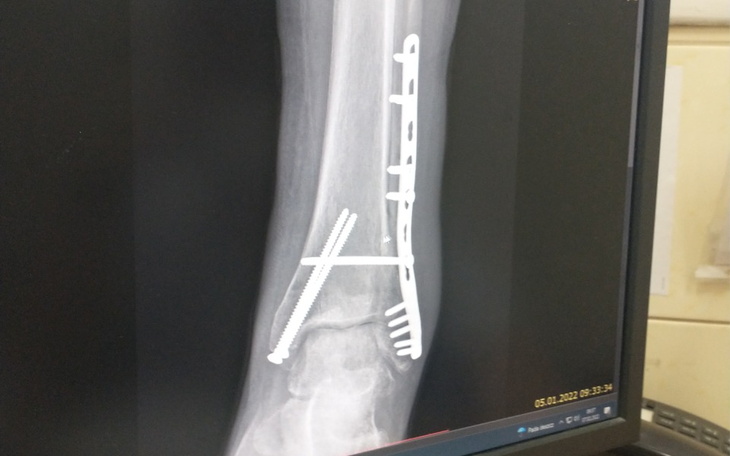 Zbiórka Prosba o pomoccc - zdjęcie główne