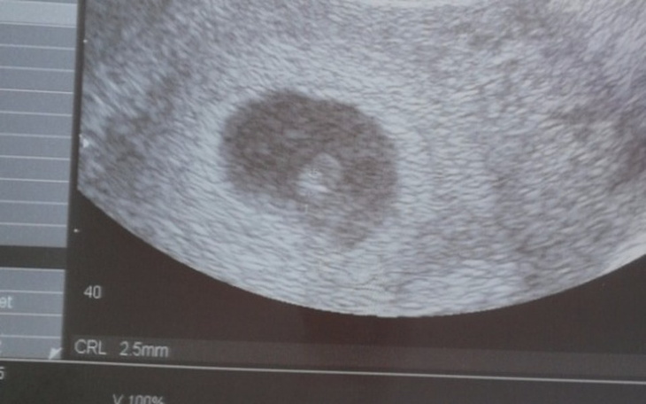 Zbiórka Bedzie dziecko a sa długi. - zdjęcie główne