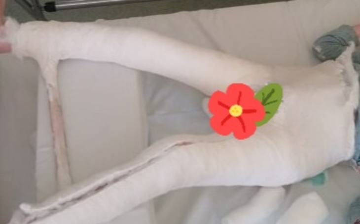 Zbiórka Pomoc dla Martynki na leczenie - zdjęcie główne