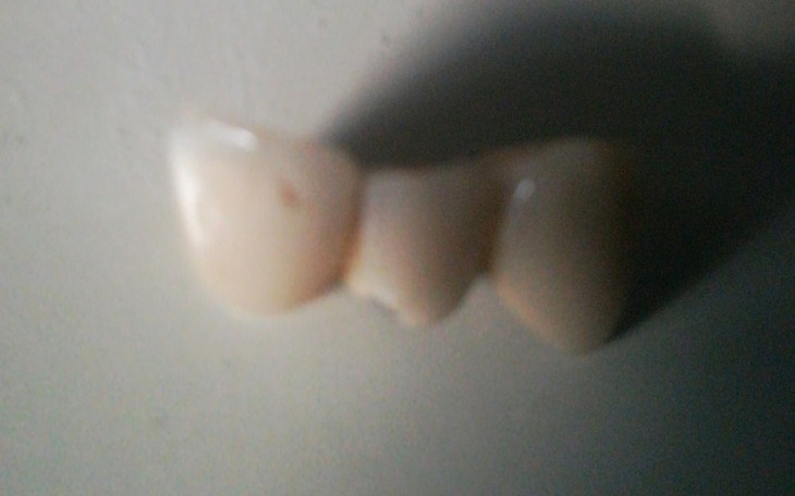 Zbiórka Zbieram na zęby bo mi wybili - zdjęcie główne