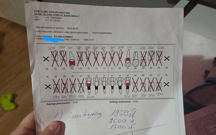 Plan leczenia z zaznaczonymi zabiegami dentystycznymi.
