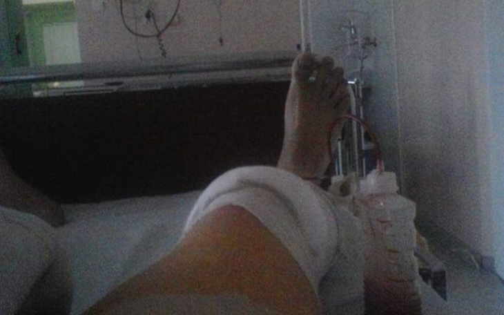 Zbiórka Implant kolana, rehabilitacja - zdjęcie główne