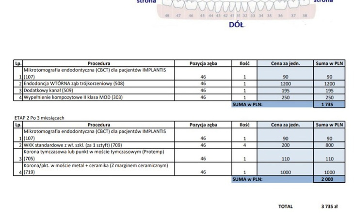 Zbiórka Zbiórka na zabieg endodoncji - zdjęcie główne