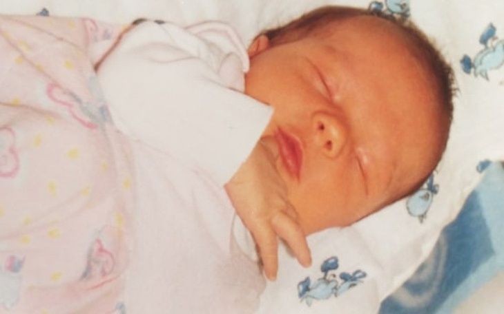 Zbiórka Nieinwazyjny bilirubinometr - zdjęcie główne