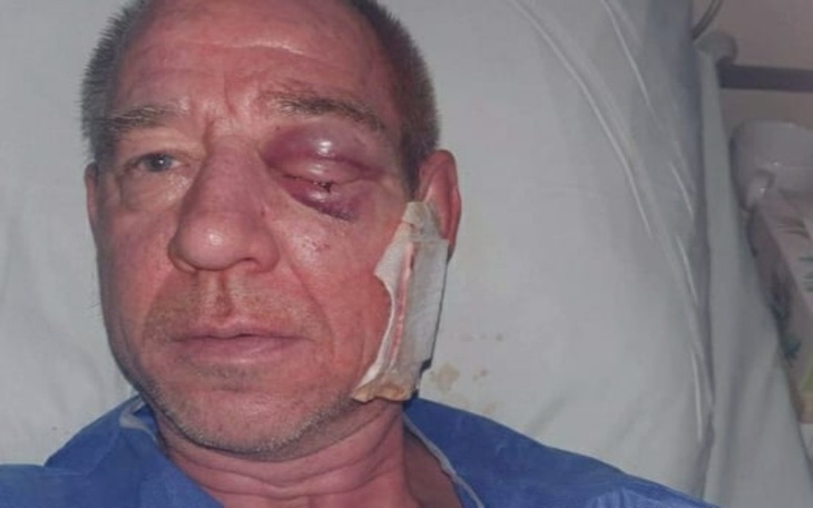 Zbiórka Proteza oka - zdjęcie główne