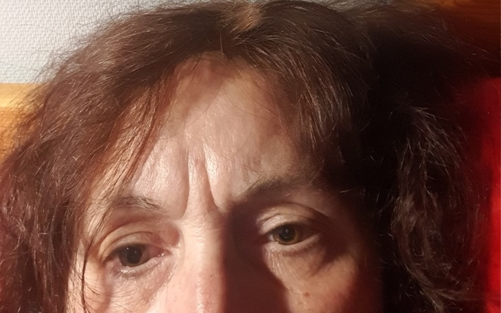 Zbiórka Rehabilitacje, leczenie, remont - zdjęcie główne