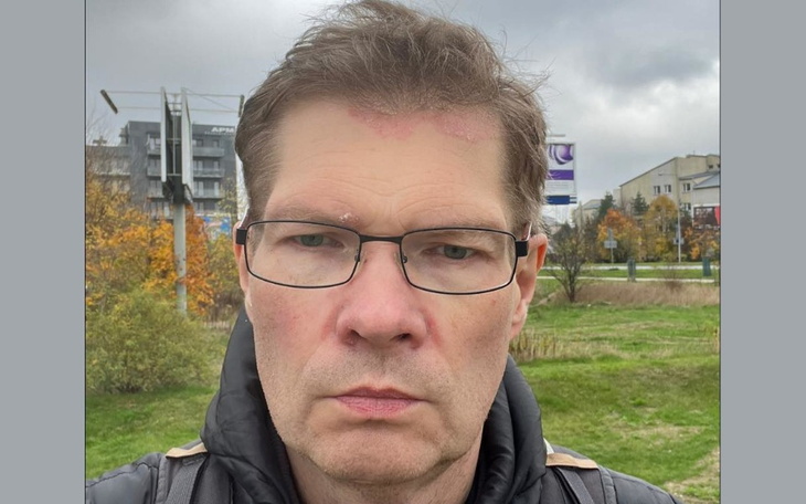 Zbiórka Ładowarka do aparatów słuchowych - zdjęcie główne