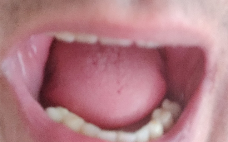 Zbiórka Chce się uśmiechać - zdjęcie główne