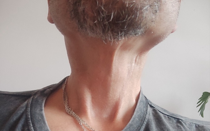 Zbiórka Nasz Tata po raku i udarze - zdjęcie główne