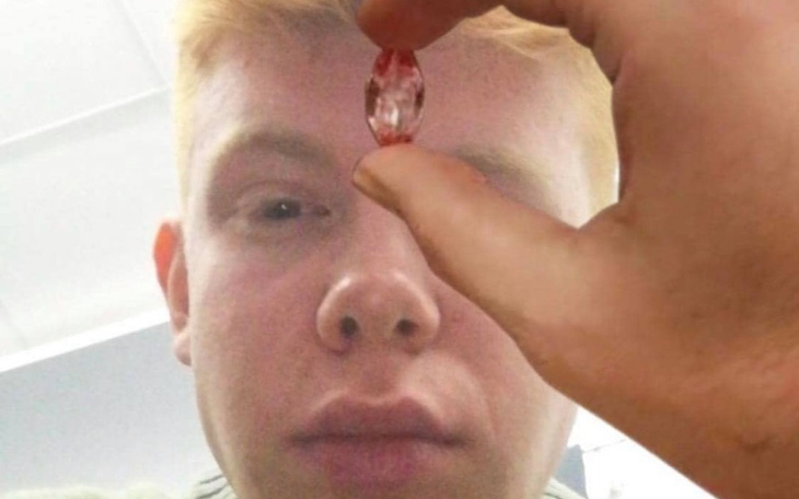 Zbiórka Dla Rudego na diament na czole - zdjęcie główne