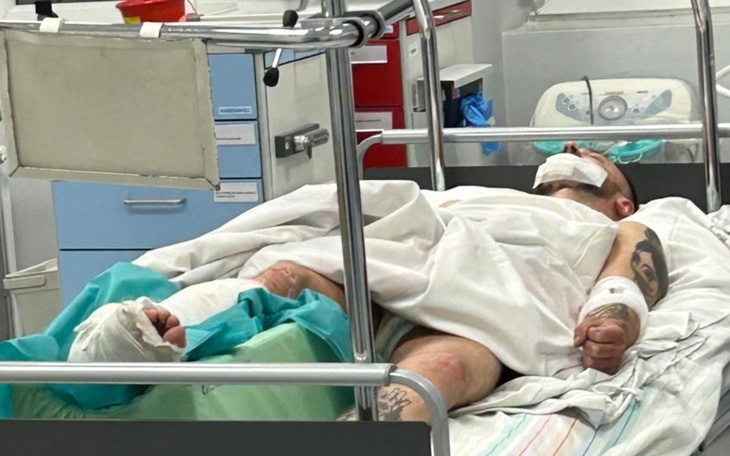 Osoba leżąca w szpitalu z opatrunkami na ciele.