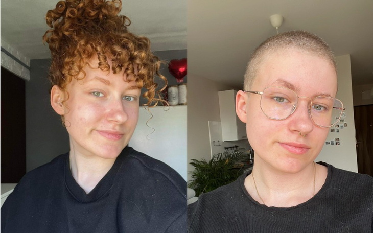 Zbiórka Na leczenie choroby skórnej - zdjęcie główne