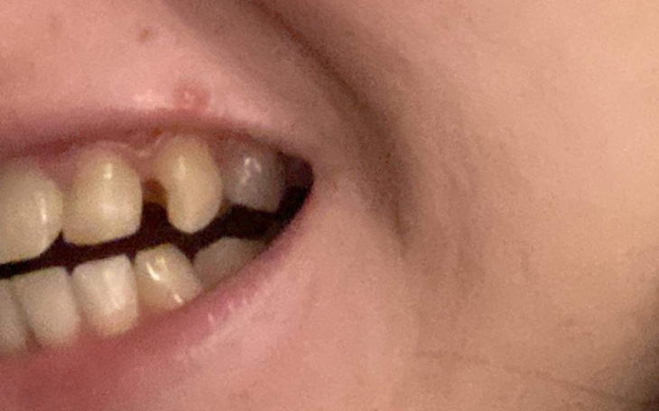 Zbiórka Na lepsze życie i piękny uśmiech - zdjęcie główne