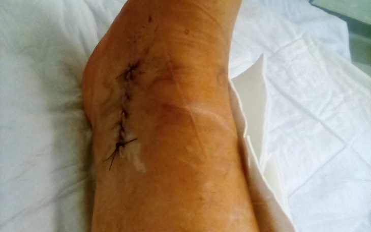 Zbiórka Zbieram na rechabilitacije - zdjęcie główne