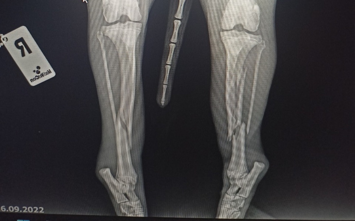 Zbiórka Operacja dla naszego psa Roko - zdjęcie główne