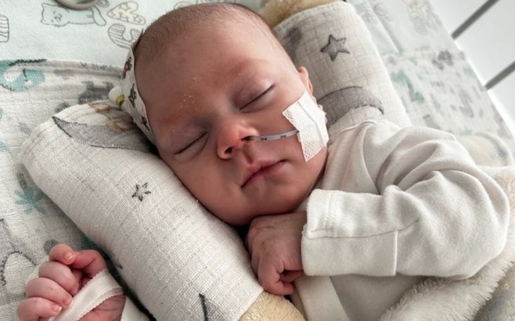 Noworodek śpiący z rurką tlenową.