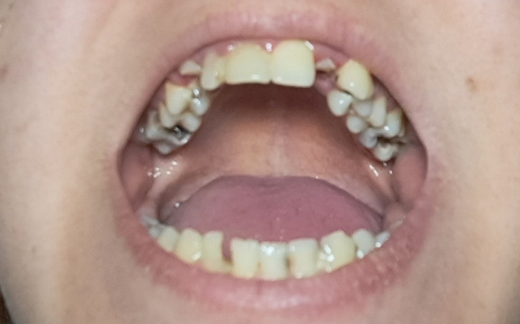 Zbiórka Pomóżcie naprawić moje zęby - zdjęcie główne