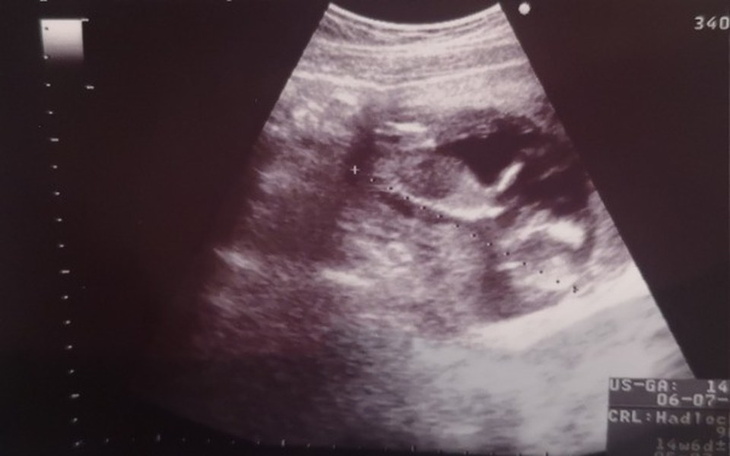 Zbiórka Wyprawka dla dziecka. - zdjęcie główne