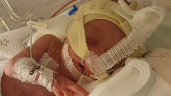 Zbiórka 750 gramów walki o życie - miniaturka zdjęcia