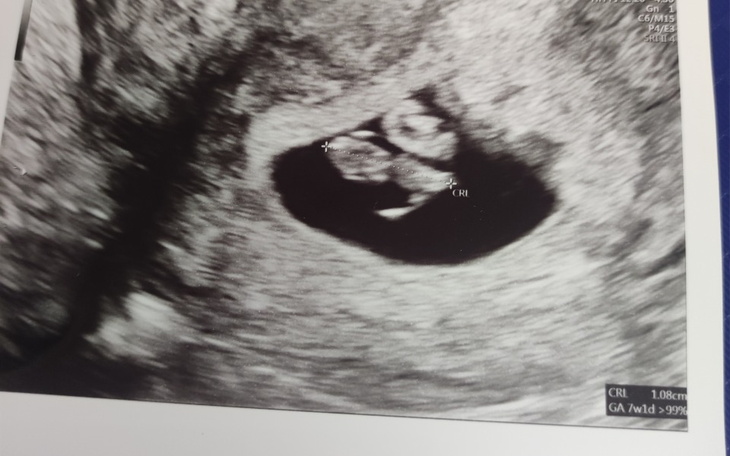 Zbiórka Badania genetyczne oraz wizyty. - zdjęcie główne