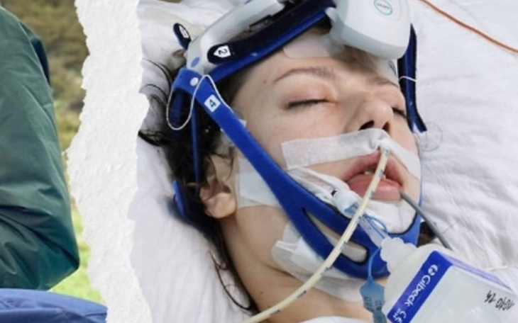 Kobieta w szpitalu, podłączona do aparatury medycznej.