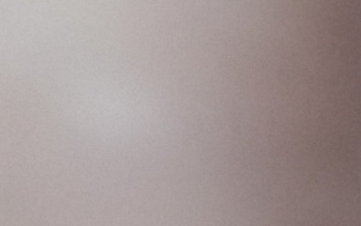 Zbiórka Usunięcie blizn powypadkowych - zdjęcie główne