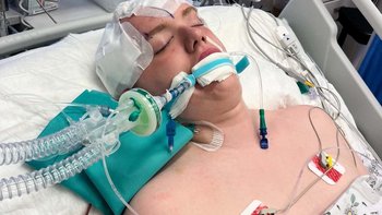 Zbiórka Pomóż Michałowi wrócić do pełnego życia po wypadku - miniaturka zdjęcia