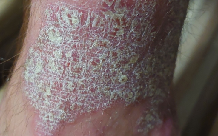 Skóra z widocznymi zmianami, prawdopodobnie chorobowymi.