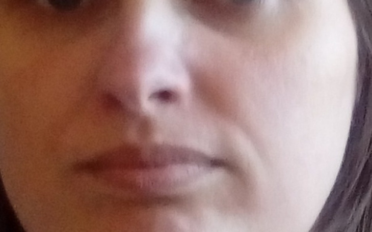 Zbiórka Na remont wozka elektrycznego - zdjęcie główne