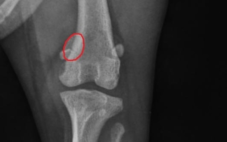 Zbiórka Leczenie operacyjne zwichnięcia - zdjęcie główne