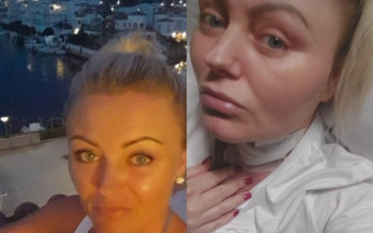 Kobieta w dwóch ujęciach, z widokiem na miasto w tle.