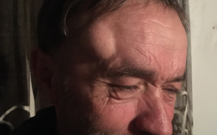 Mężczyzna z zamyśloną miną, z widocznymi zmarszczkami na twarzy.