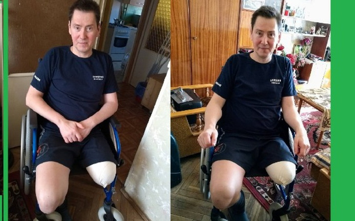 Zbiórka Proteza lewej nogi - zdjęcie główne