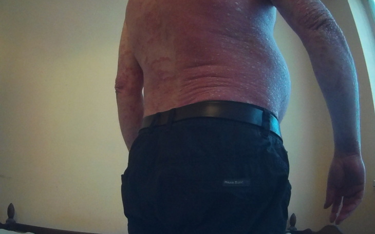 Zbiórka Dla chorego na zimę - zdjęcie główne