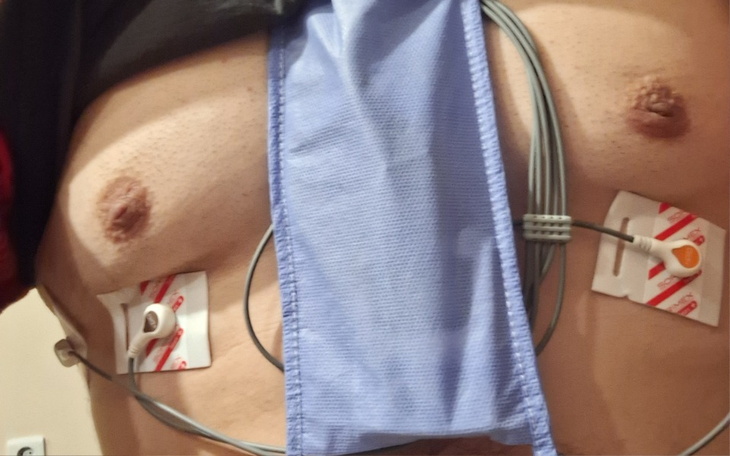 Zbiórka Problemy zdrowotne z sercem - zdjęcie główne