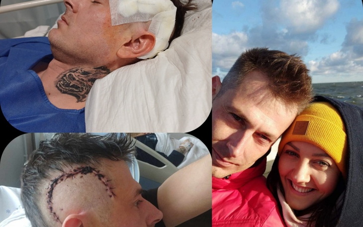 Kolaż zdjęć mężczyzny po operacji, z bliznami i zdjęciem z bliską osobą.